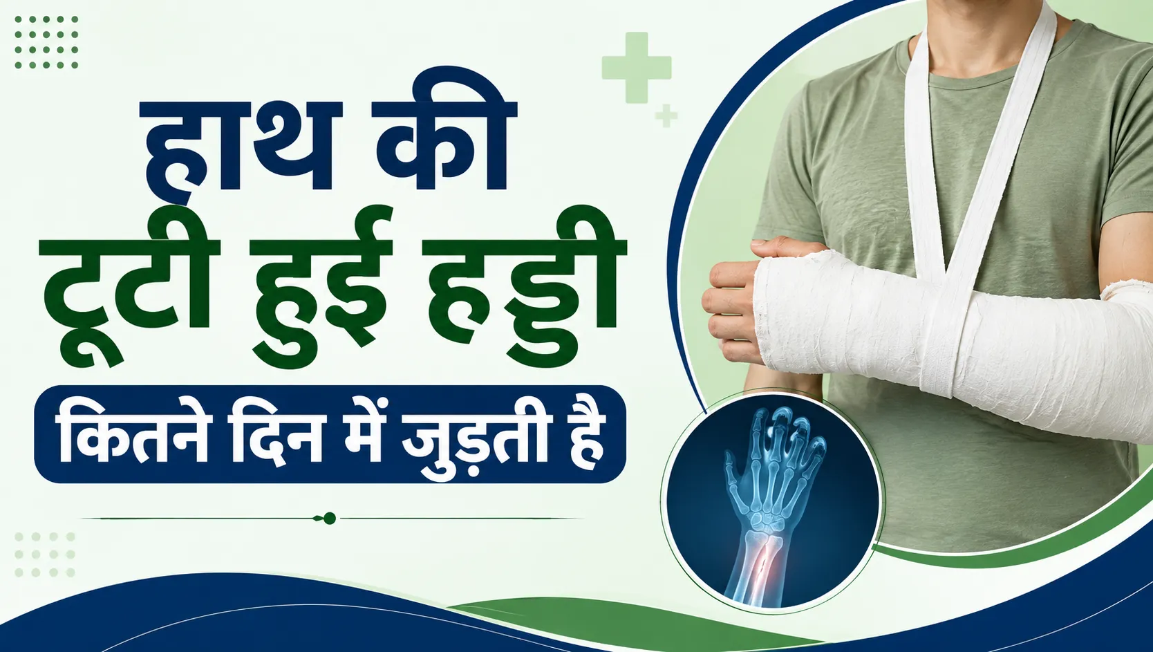 हाथ की टूटी हुई हड्डी कितने दिन में जुड़ती है